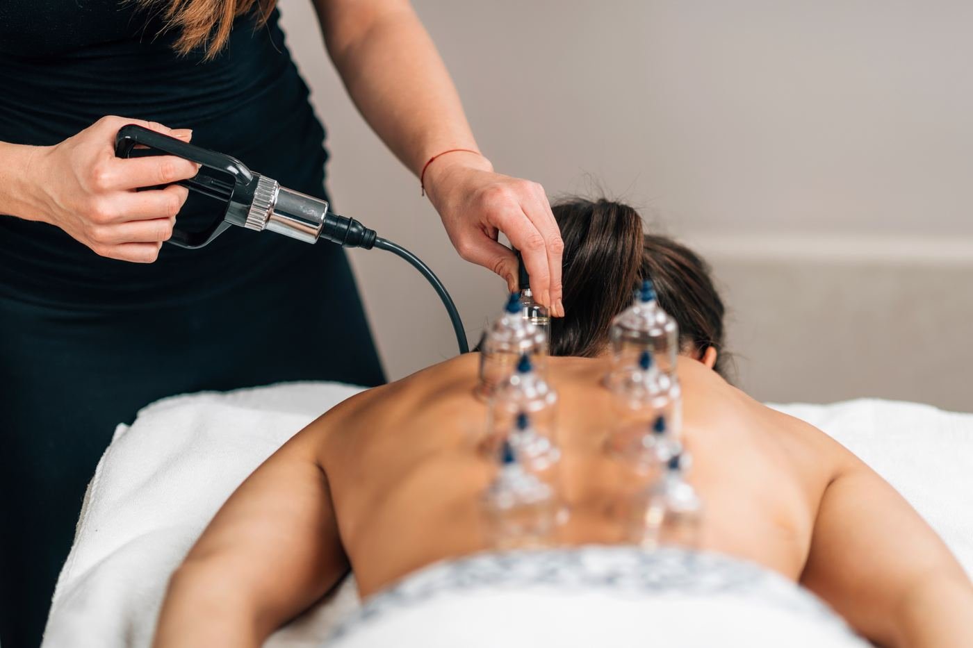 Cupping therapy at Kaizen